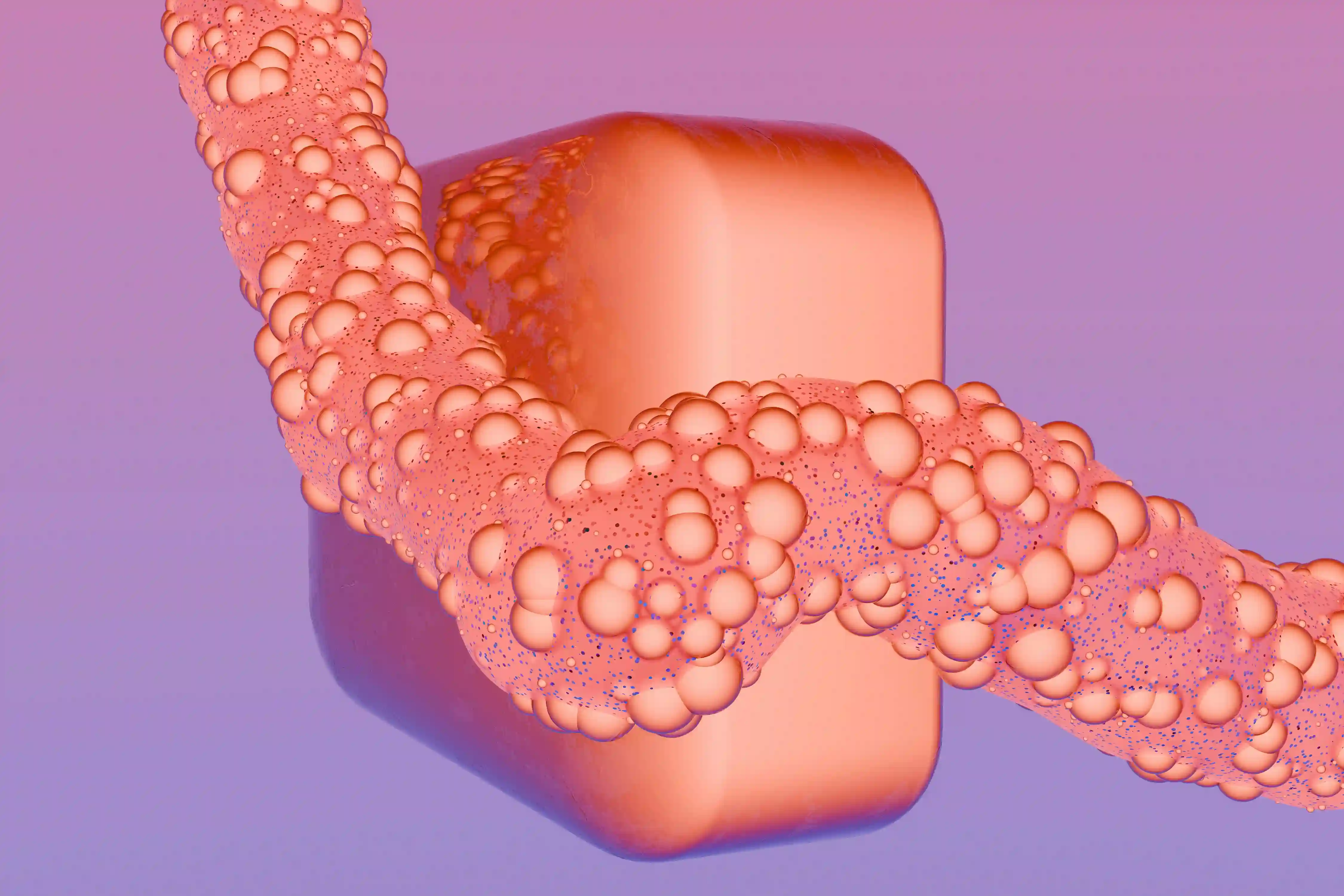 A picture showing ulcerative colitis.